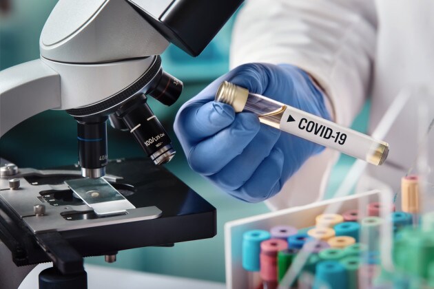 ASP MESSINA – Convenzione con laboratorio privato per l’esame di 300 tamponi Covid-19 al giorno
